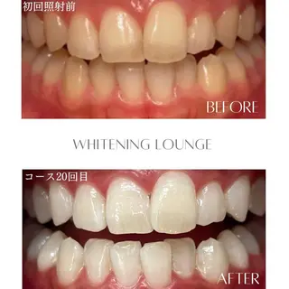 ホワイトニング Lounge横須賀のエステ・リラクイメージ