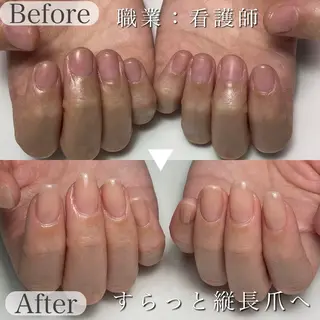 ネイル 深爪専門店 サロンリリーのネイルデザイン