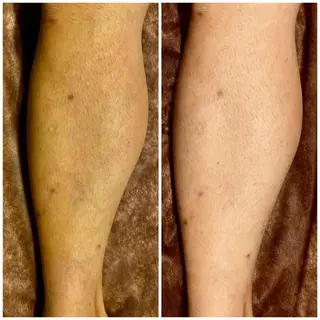 プルケル スパのエステ・リラクイメージ