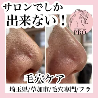 毛穴専門店hula 杉山智美のエステ・リラクイメージ