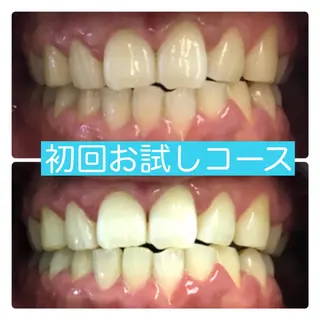 ホワイトニングルーム 横浜店のその他イメージ