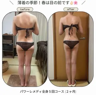 《本気痩せ×疲労改善 》  BILOOPのエステ・リラクイメージ