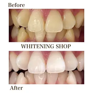 ホワイトニング ショップ伊丹店のその他イメージ