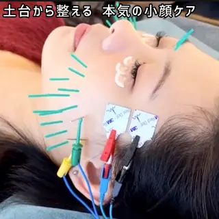 渋谷 小顔美容鍼 専門サロン YZのエステ・リラクイメージ