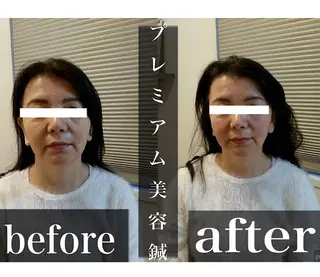 鍼灸 Refineのその他イメージ