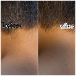 メンズ キッズ メンズ脱毛サロン SHINKAのエステ・リラクイメージ