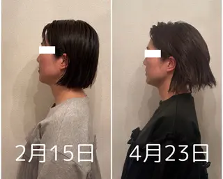 Lily luce 美骨小顔矯正のその他イメージ