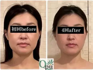 Qpu(キュープ)下北沢店所属・鮎川 さゆりのエステ・リラクイメージ