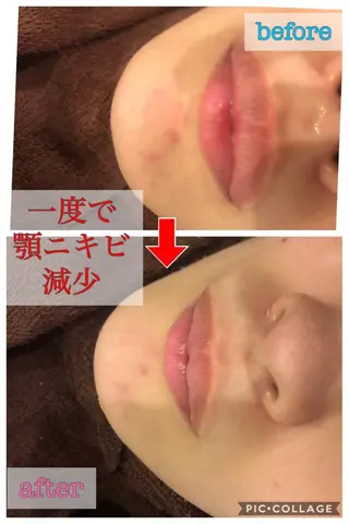 ミディアム カラー パーマ ヘアアレンジ メンズ キッズ ネイル マツエク・マツパ 金の糸脱毛 産毛ケア専門のエステ・リラクイメージ