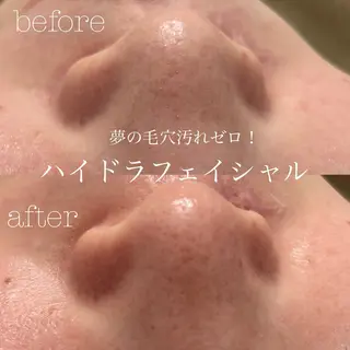 フェイシャルサロン CHIARA 荒田のエステ・リラクイメージ