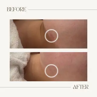 CEsalonEgg 齋藤のエステ・リラクイメージ