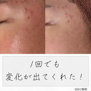 ニキビ経験者が施術 する専門サロン🌻のエステ・リラクイメージ