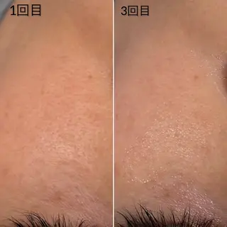 Éclat de Belle🫧白玉肌のその他イメージ