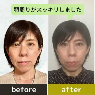 小顔&ヘッドスパ/ もりもとまきみのエステ・リラクイメージ