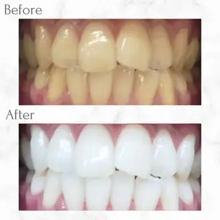 エクシア天神店 💟marinのその他イメージ