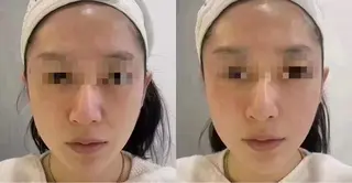 ネイル aliaハーブ水光店 エステティシャン募集のエステ・リラクイメージ