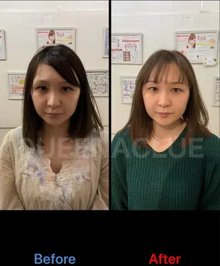 ミディアム カラー ネイル 毛穴改善/脱毛 ネイル　川上久仁子のエステ・リラクイメージ
