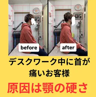 肩こり頭痛さようなら 整体カタギリのエステ・リラクイメージ