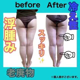 痩身/脱毛/ネイル HARUKAのエステ・リラクイメージ