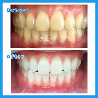 Mon Cheri 広島店のエステ・リラクイメージ