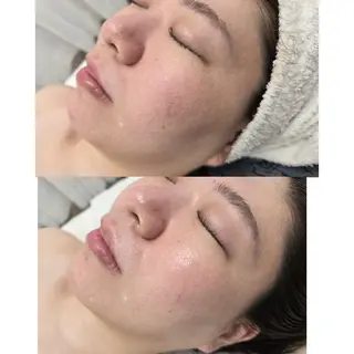 Belle〜ベル〜所属・エステサロン Belleのエステ・リラクイメージ