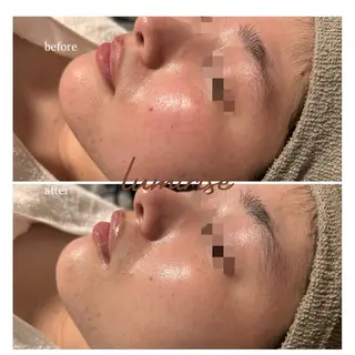 lumi riseのエステ・リラクイメージ