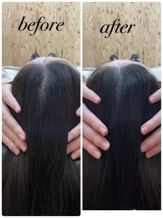 個室ドライヘッドスパ 🍃moriのエステ・リラクイメージ