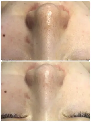 LILIANA ☆YURIのエステ・リラクイメージ