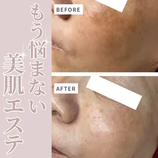 伊藤 稚菜のエステ・リラクイメージ