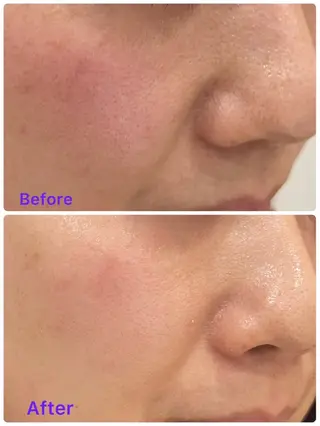 メナードフェイシャルサロン　リンガーデン所属・田中 友佳理のエステ・リラクイメージ