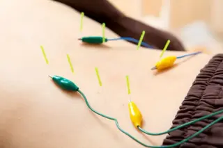 💙美容鍼💙美顔矯 正🧡Brilo🧡のエステ・リラクイメージ