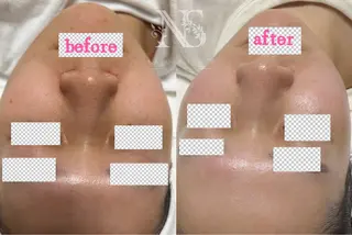 Nature Souce毛穴専門店のその他イメージ