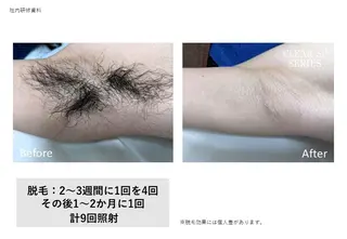 メンズ トータルクリア TAOKAのエステ・リラクイメージ