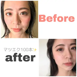 マツエク・マツパ chie 。のヘアスタイル