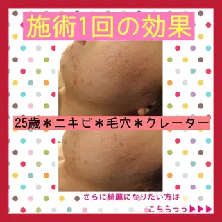 ミディアム カラー パーマ ヘアアレンジ メンズ キッズ ネイル マツエク・マツパ ニキビ・肌質改善専門 ♡人生が変わるサロンのエステ・リラクイメージ