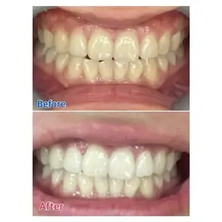 M渋谷店所属・M渋谷 ホワイトニングのエステ・リラクイメージ