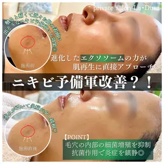 La Dusa 韓国肌管理/小波のエステ・リラクイメージ