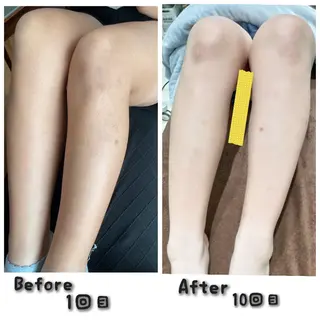 キッズ エステティクサロン Moon-bellのエステ・リラクイメージ