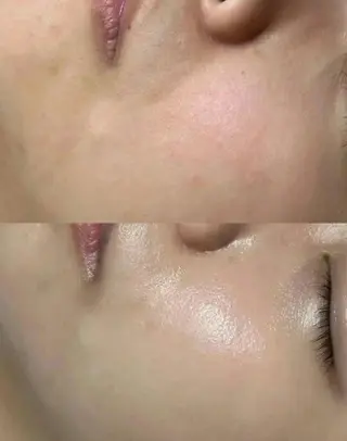 Queen Salonのエステ・リラクイメージ