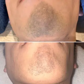 韓国美容×肌管理 kanunu鶴橋店のエステ・リラクイメージ