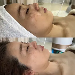 salondeBe 🩵フェイシャル専門のエステ・リラクイメージ