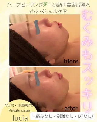 lucia  豊明 肌管理のエステ・リラクイメージ