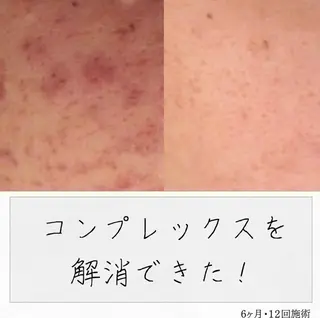 ニキビ経験者が施術 する専門サロン🌻のエステ・リラクイメージ