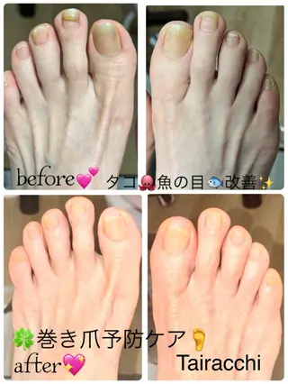 ネイル Tairacchi タイラッチのネイルデザイン