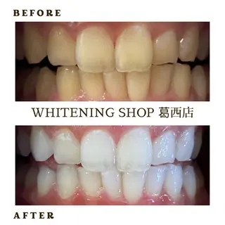 ホワイトニング ショップ葛西店のその他イメージ