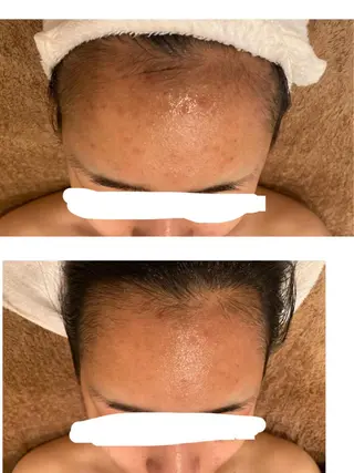 メナードフェイシャル サロン片町店ハタケのエステ・リラクイメージ