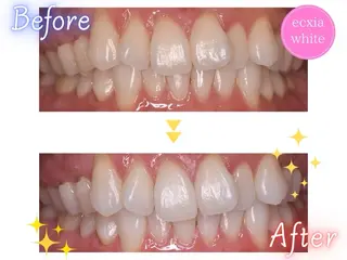 エクシアホワイトニング草津店所属・nanami -ホワイトニングのその他イメージ