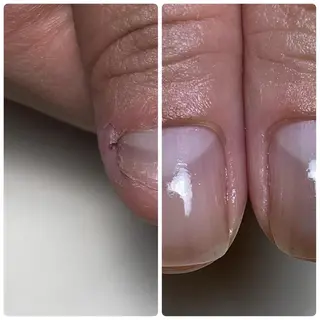 ネイル Nail ビ爪のネイルデザイン