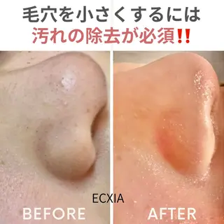 ECXIA 【エクシア】のエステ・リラクイメージ
