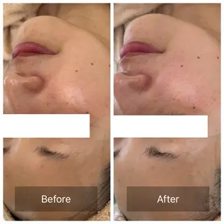 facial aesthetic salon SENTEUR所属・美肌改善/毛穴/シミ サントゥールのエステ・リラクイメージ